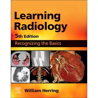 Learning Radiology E-Book : Learning Radiology E-Book